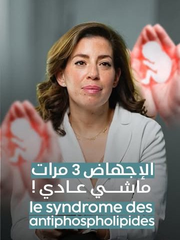 Fausses couches répétées : syndrome des antiphospholipides